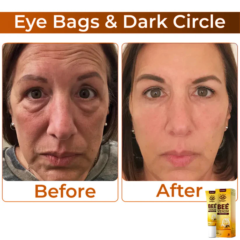 COLLAGEN+ BEE VENOM WAKE UP EYE CREAM (PACK OF 2)