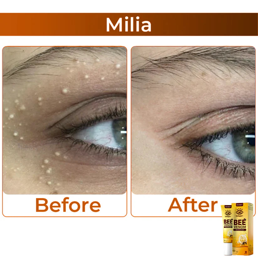 COLLAGEN+ BEE VENOM WAKE UP EYE CREAM (PACK OF 2)