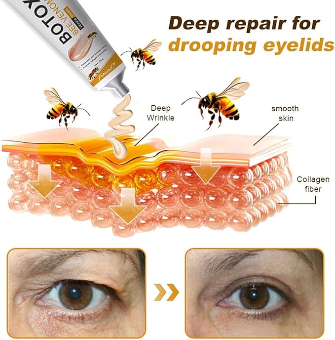 BOTOXIN BEE VENOM ANTI -AGEING CREAM (BUY 1 GET 1 FREE)
